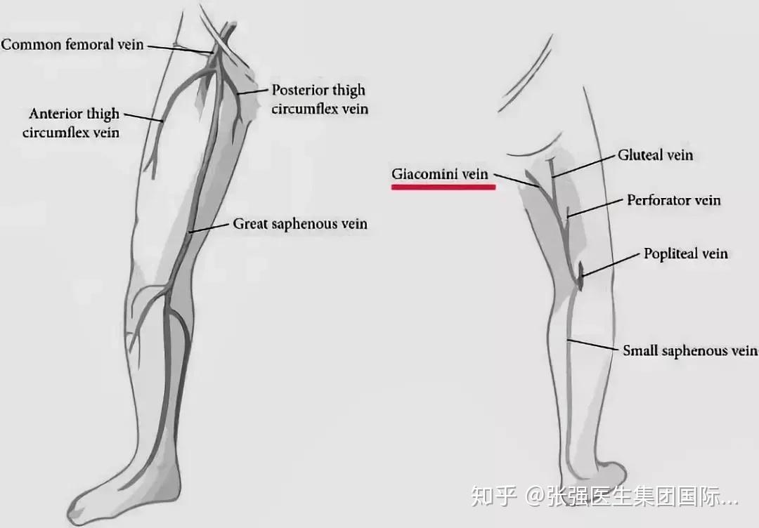 忽视了这条下肢静脉血流动力学的评估和处理很多静脉曲张复发了