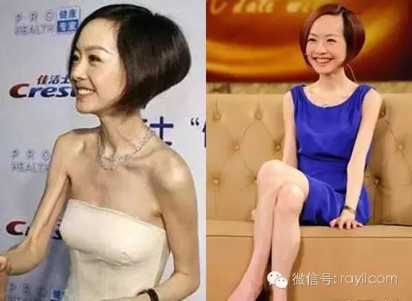 女生到底会不会因为太瘦而一点胸部都没有?答案是肯定的!