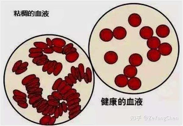 血液的特性 - 知乎