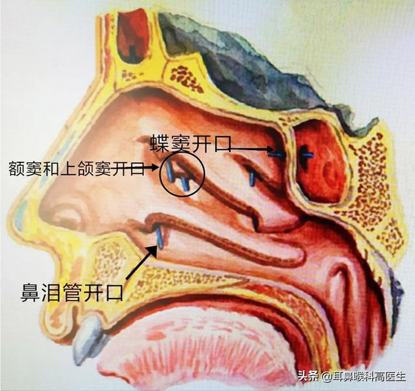 本人慢性鼻窦炎三个月治愈计划 - 知乎