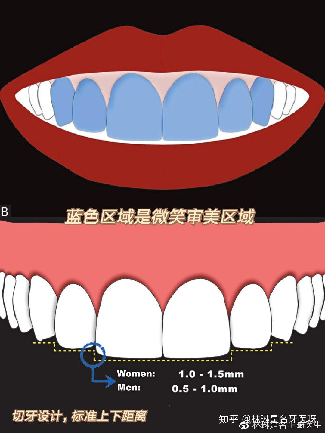 笑弧是每个人都有的么图片