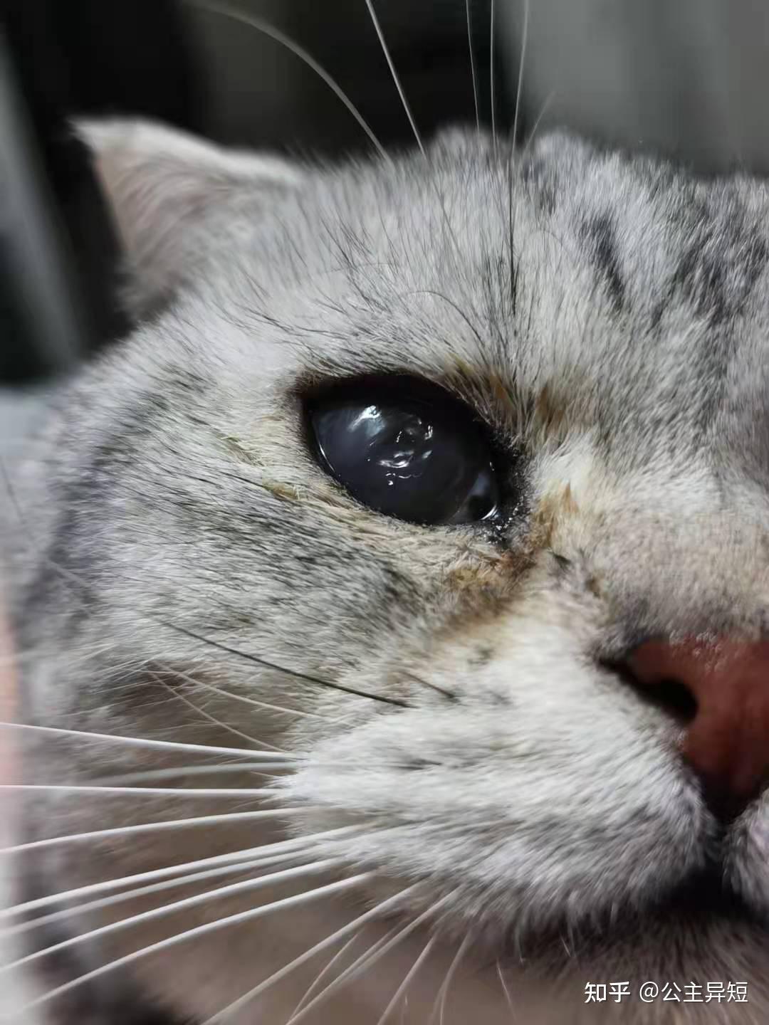 猫眼疮红斑图片图片