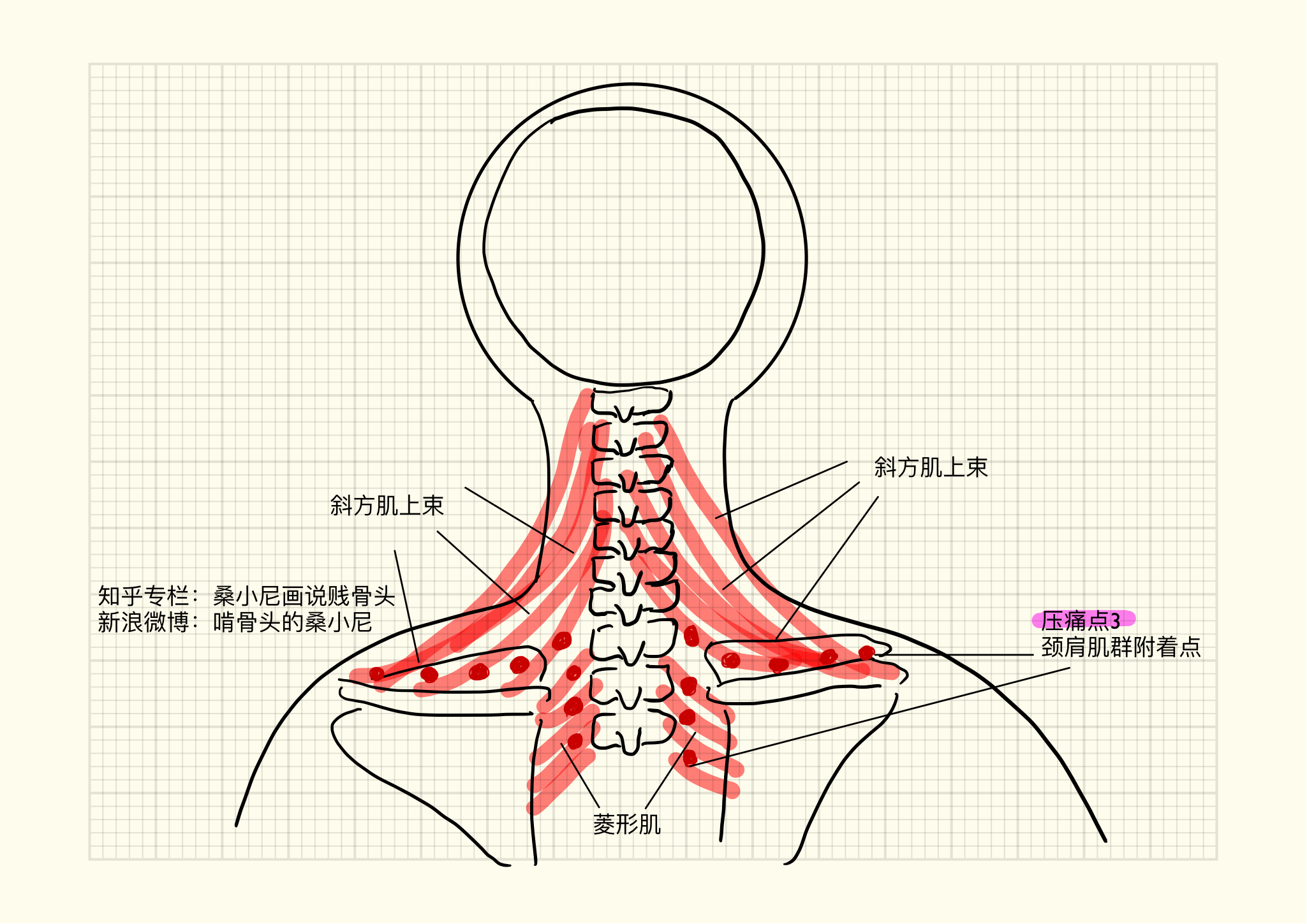 颈半棘肌起止点解剖图-千图网