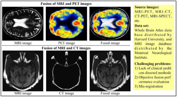 像素级图像融合综述 - 知乎