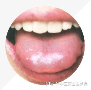 史上最全舌诊图谱!【珍藏版】 - 知乎