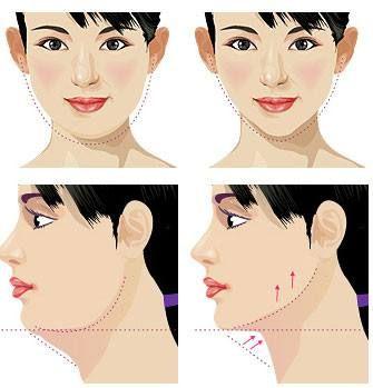 怎么瘦脸上的肌肉和脂肪 v2-421448c5dcff3cb70958377e4c621c72_1200x500.jpg