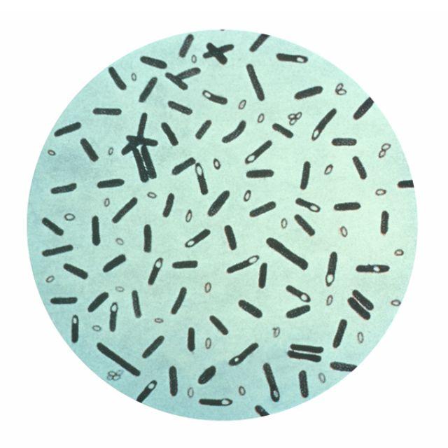 白喉棒状杆菌镜下形态图片