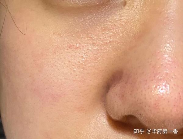 怎么把自己皮肤养的好好的 知乎