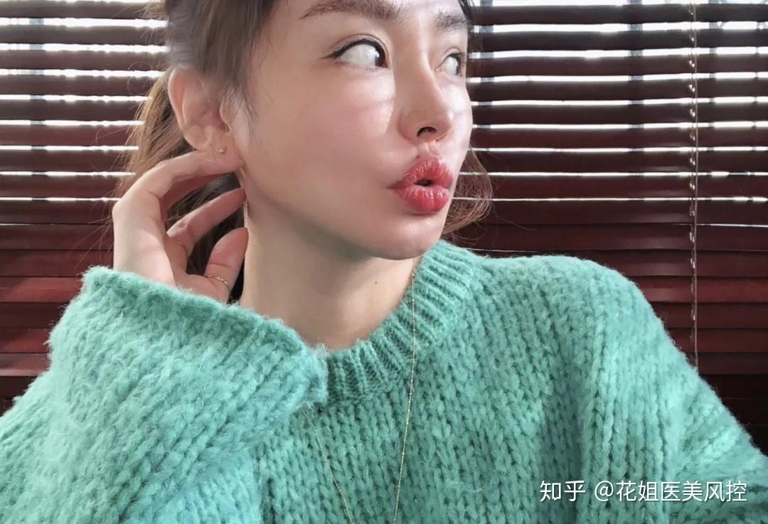 lipo小颜你的花姐团第一站