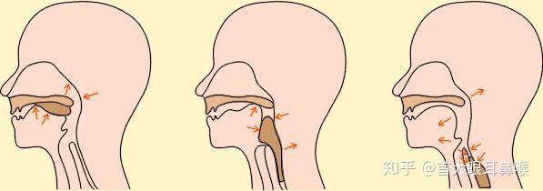 吞咽的时候,会厌伏倒,遮住气管入口,食物就能顺势进入食道了.