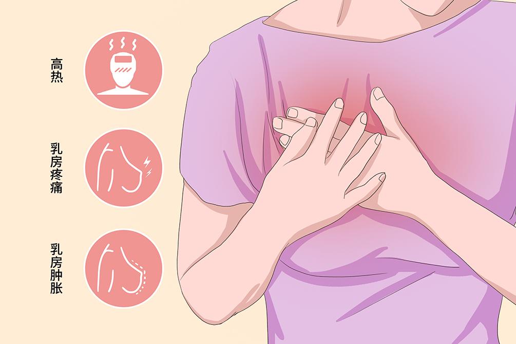 还有的表现为慢性乳房肿块,症状较重会导致乳房剧痛,哺乳期乳腺炎可能