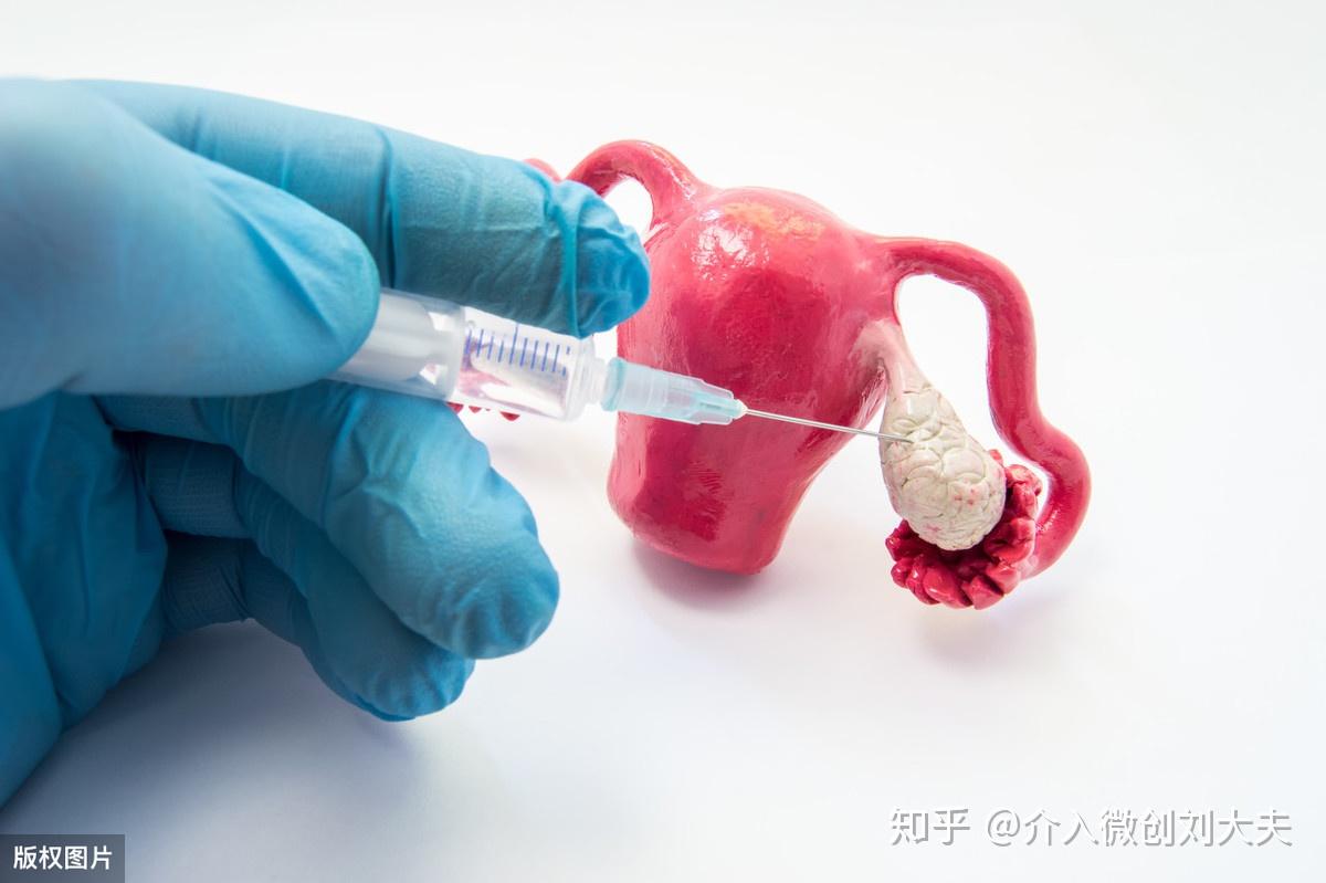外阴囊肿是什么原因引起的-中国医药信息查询平台