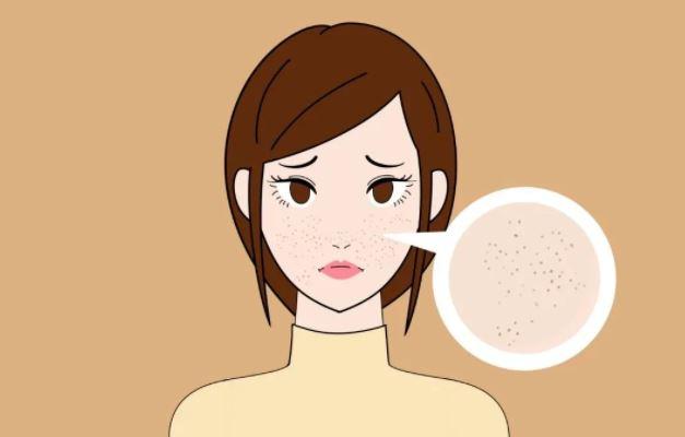 洗完澡自然风干更好?这4件事让你的皮肤越来越干