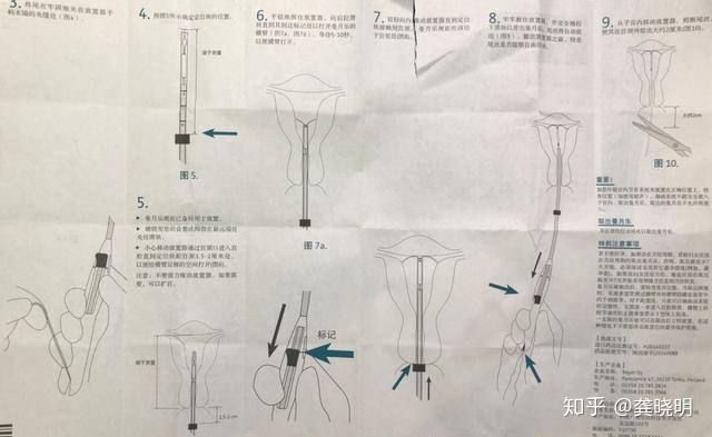 曼月乐环 说明书图片