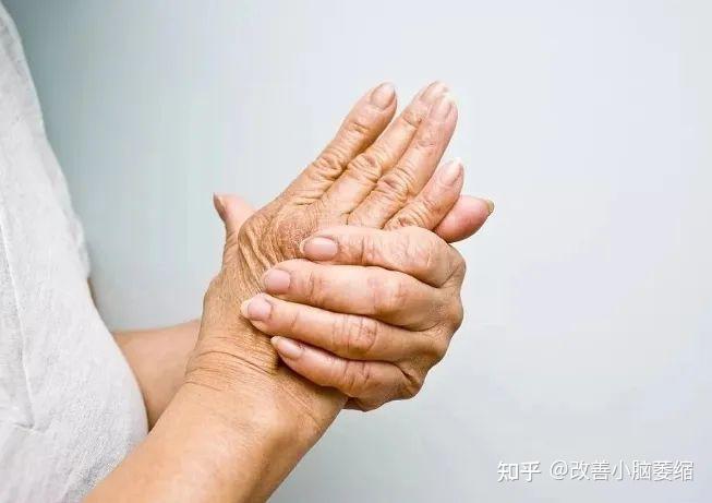 【医学科普】拿东西手抖,可能是“特发性震颤”惹的祸 - 知乎