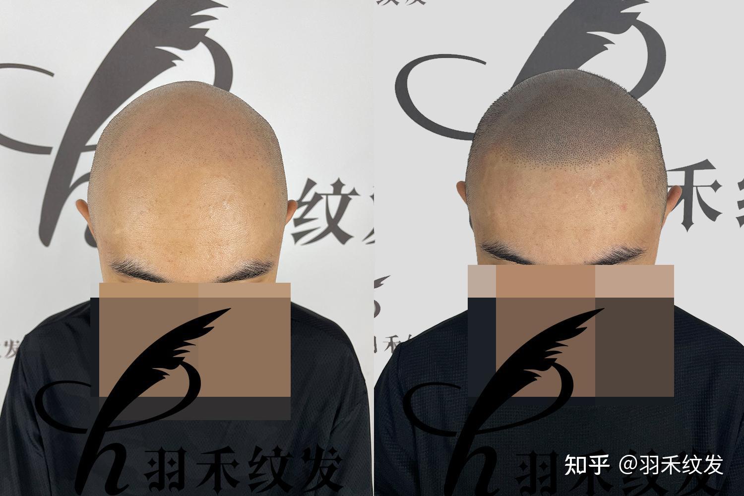 纹发后为什么视觉上有立体感? - 知乎