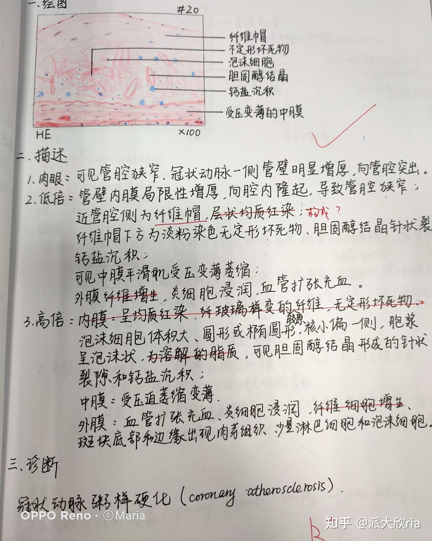 病理學實驗報告紅藍鉛筆手繪圖有老師批改