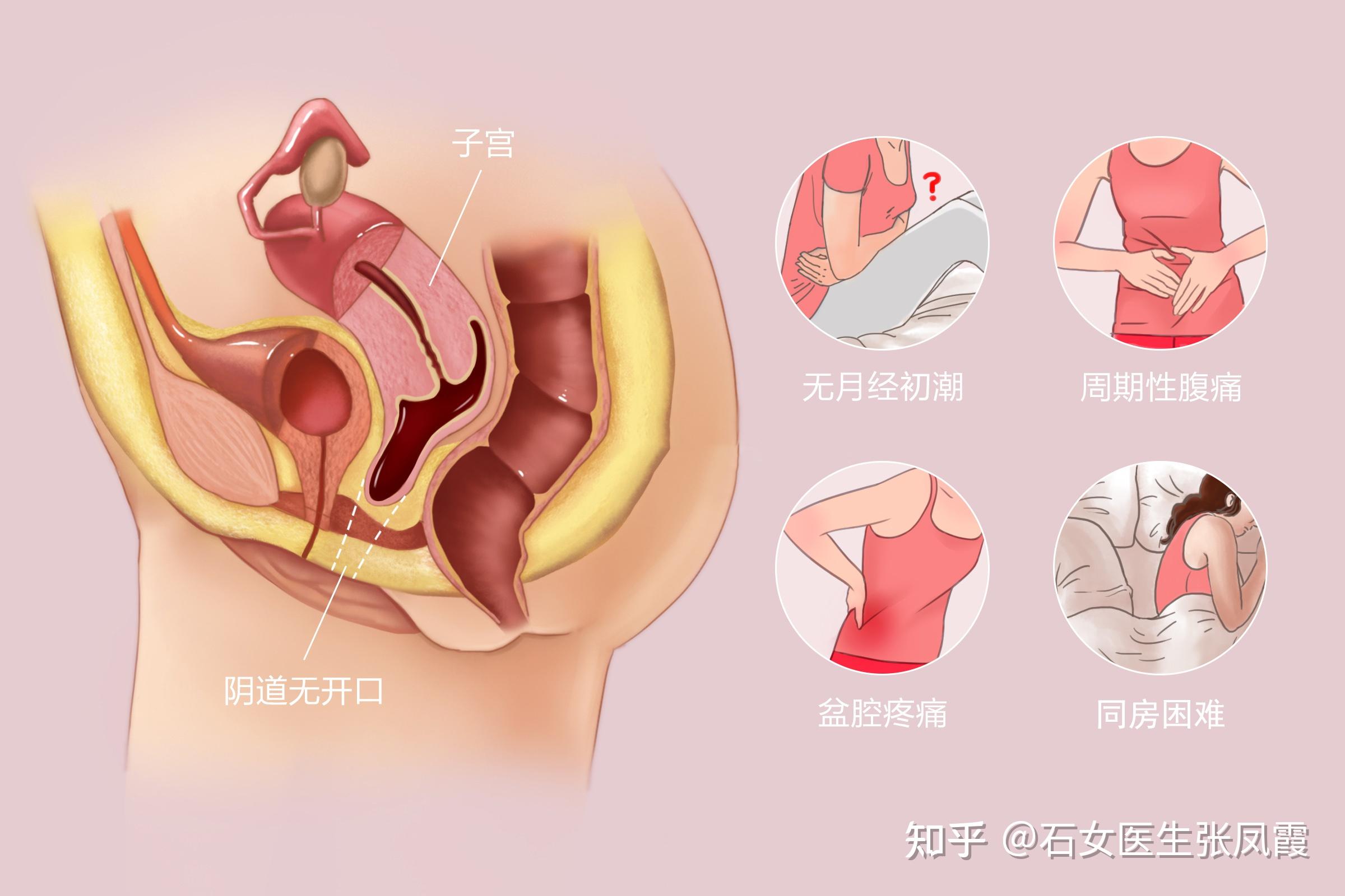 12岁子宫图片