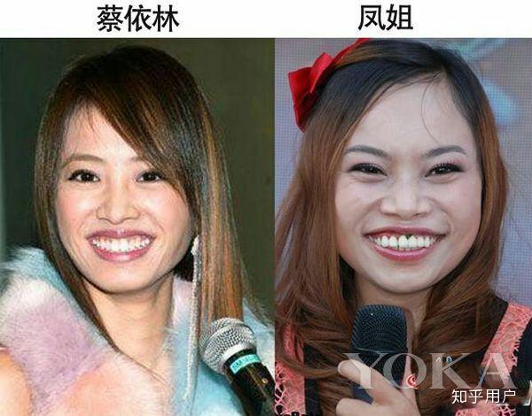 有哪些明星撞脸的