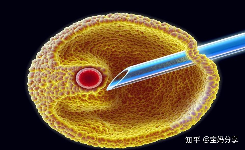 卵巢卵泡长到多大可以取卵,卵泡13mm可以取卵吗 - 知乎