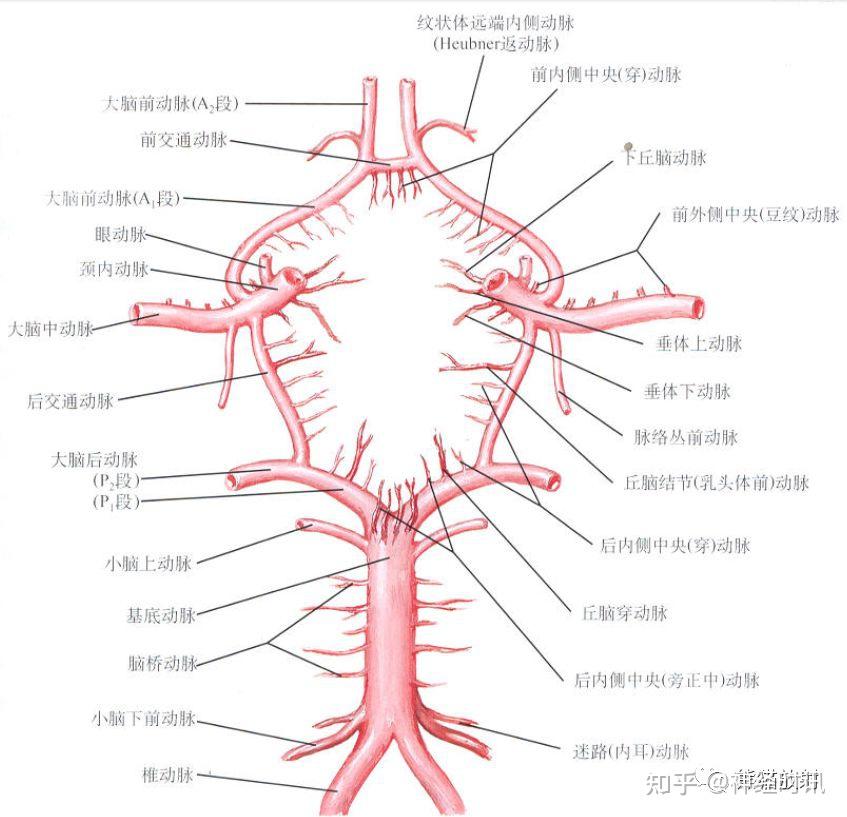 大脑后动脉TIA图片