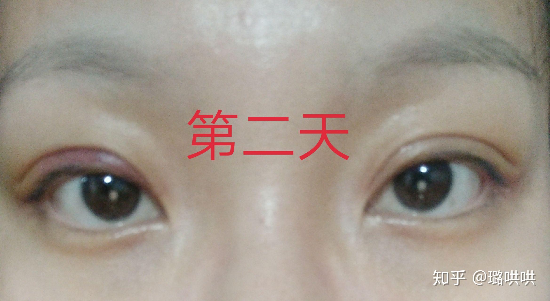 v2-44b3307f9bcee29df1b0e766ad8b11f9_r.jpg
