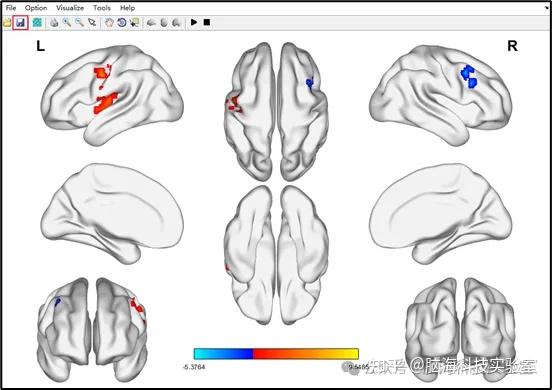 第2期 BrainNet viewer脑图绘制 - 知乎