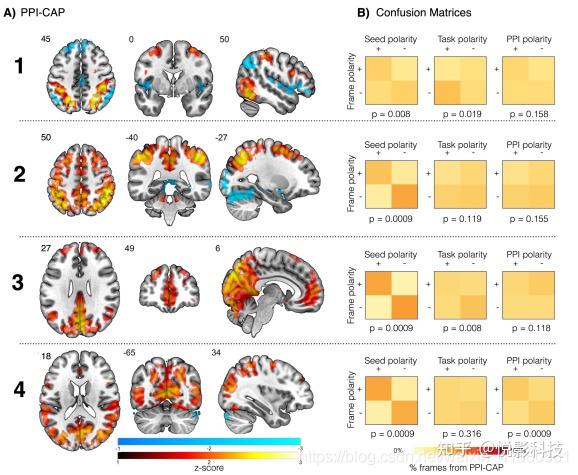 NeuroImage：任务态fMRI时间分辨的有效连接：共激活模式的心理生理交互 - 知乎