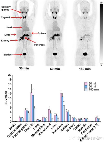 文献分享：68Ga-FAPI-RGD显像成纤维细胞活化蛋白FAP和整合素avb3对不同癌症类型中的临床评价 - 知乎