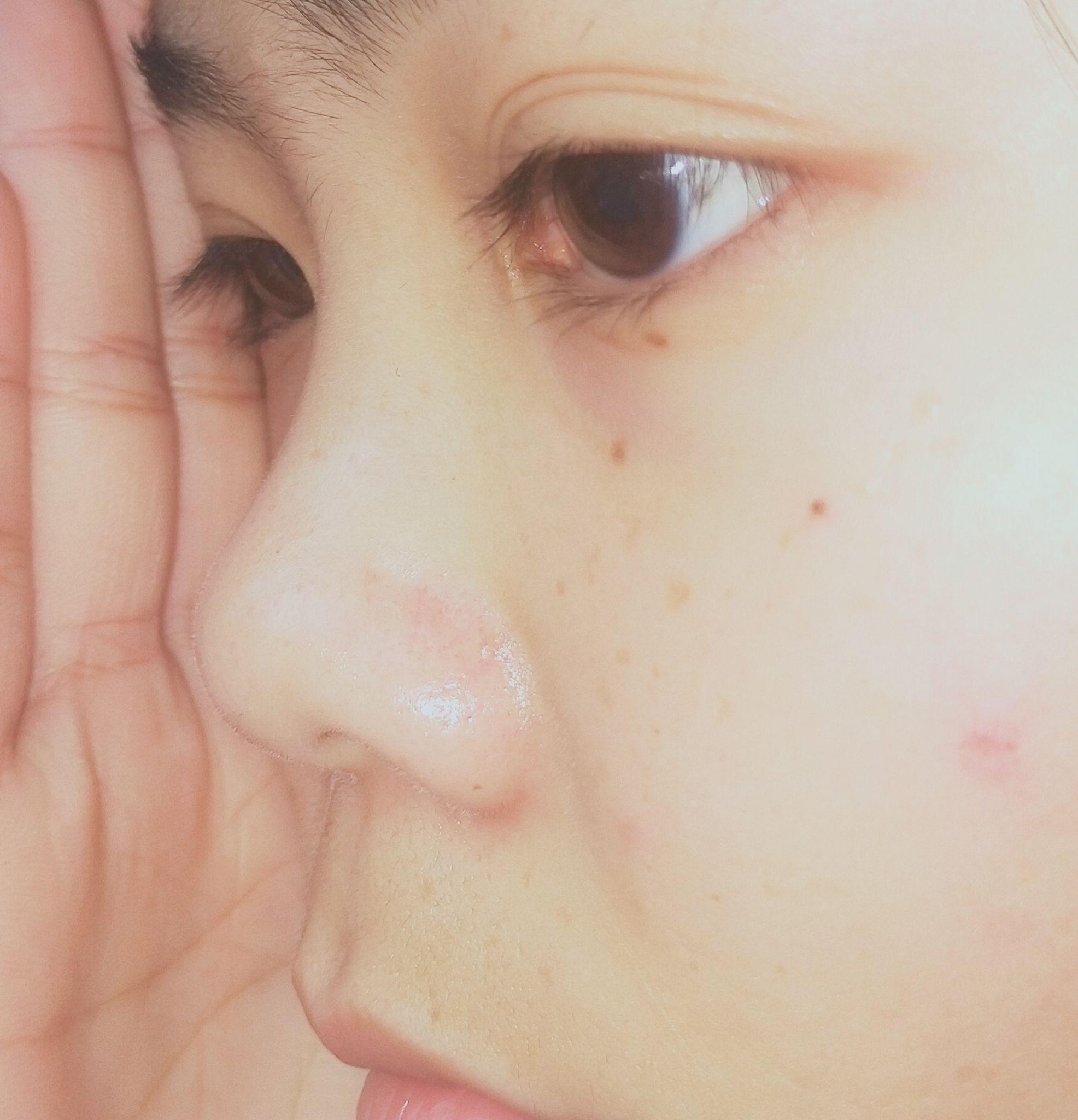 最后来几张全脸吧,我的鼻子是真的塌呀,希望姐妹们看看然