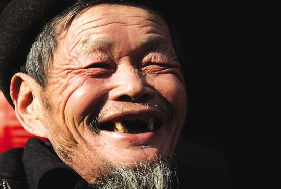 查了1500多人,中大医院神经内科张志琤教授科研团队的柏峰博士介绍说