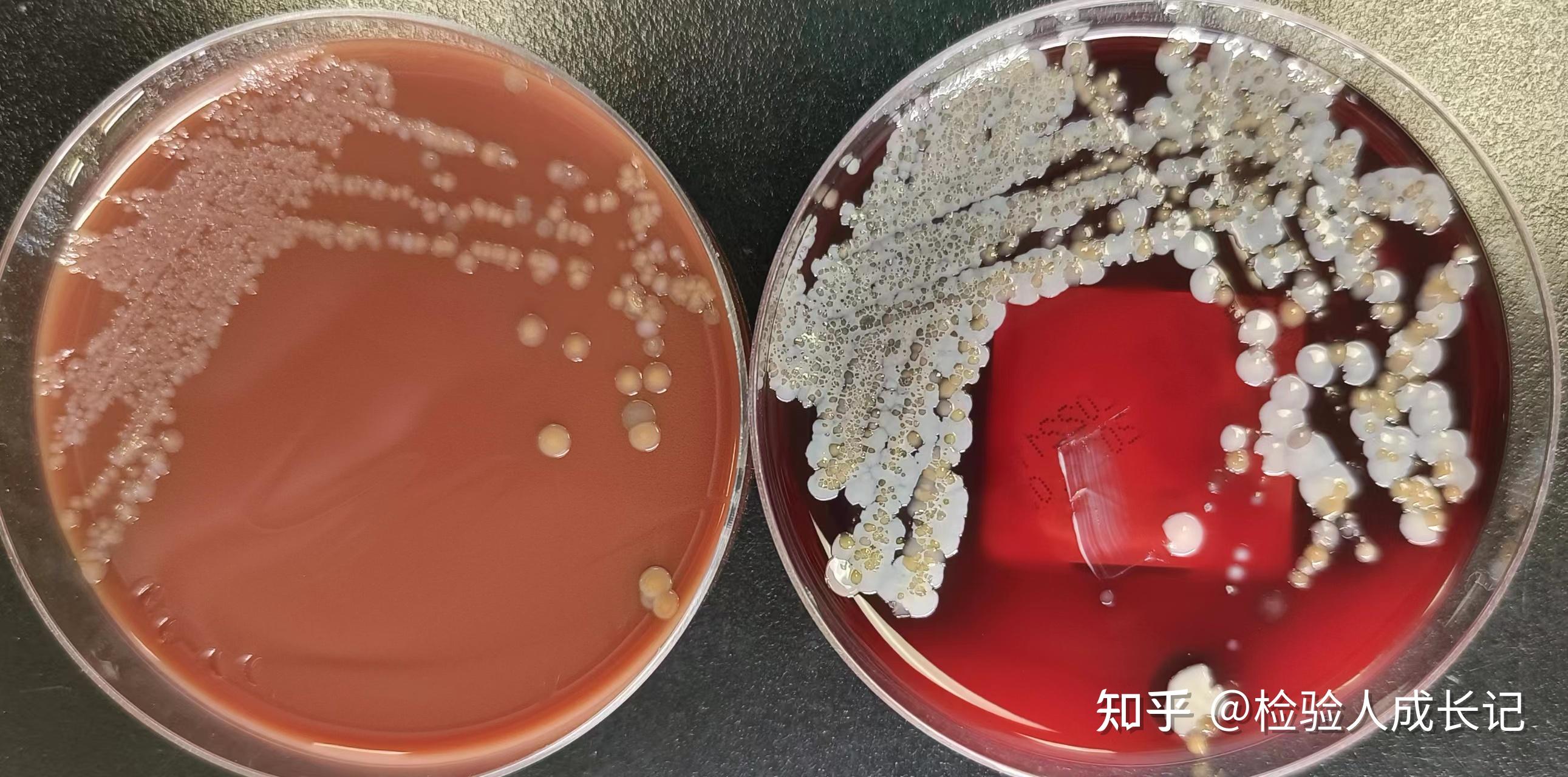 检验规培成长记-微生物检验之培养基菌落的观察 - 知乎