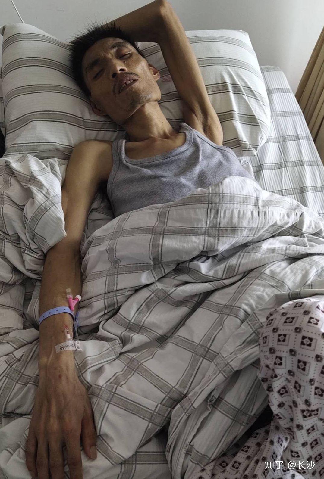 姐夫1个月暴瘦20多斤4个孩子等他回家福建平潭县41岁顶梁柱姐夫患肝癌