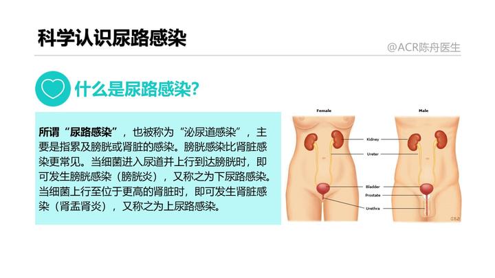女性尿路感染的小知识 知乎 女性尿路感染的小知识 知乎