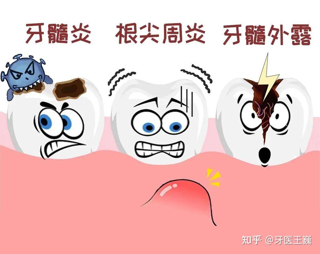 牙齿烂的只剩下残冠残根怎么办? - 知乎