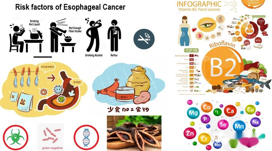 食管癌特篇一食管癌的流行病学和风险因素