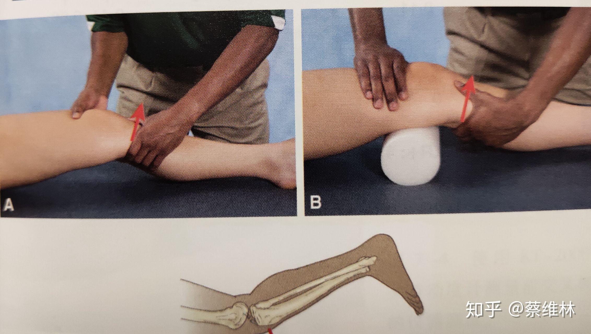 髌股疼痛综合征的评估