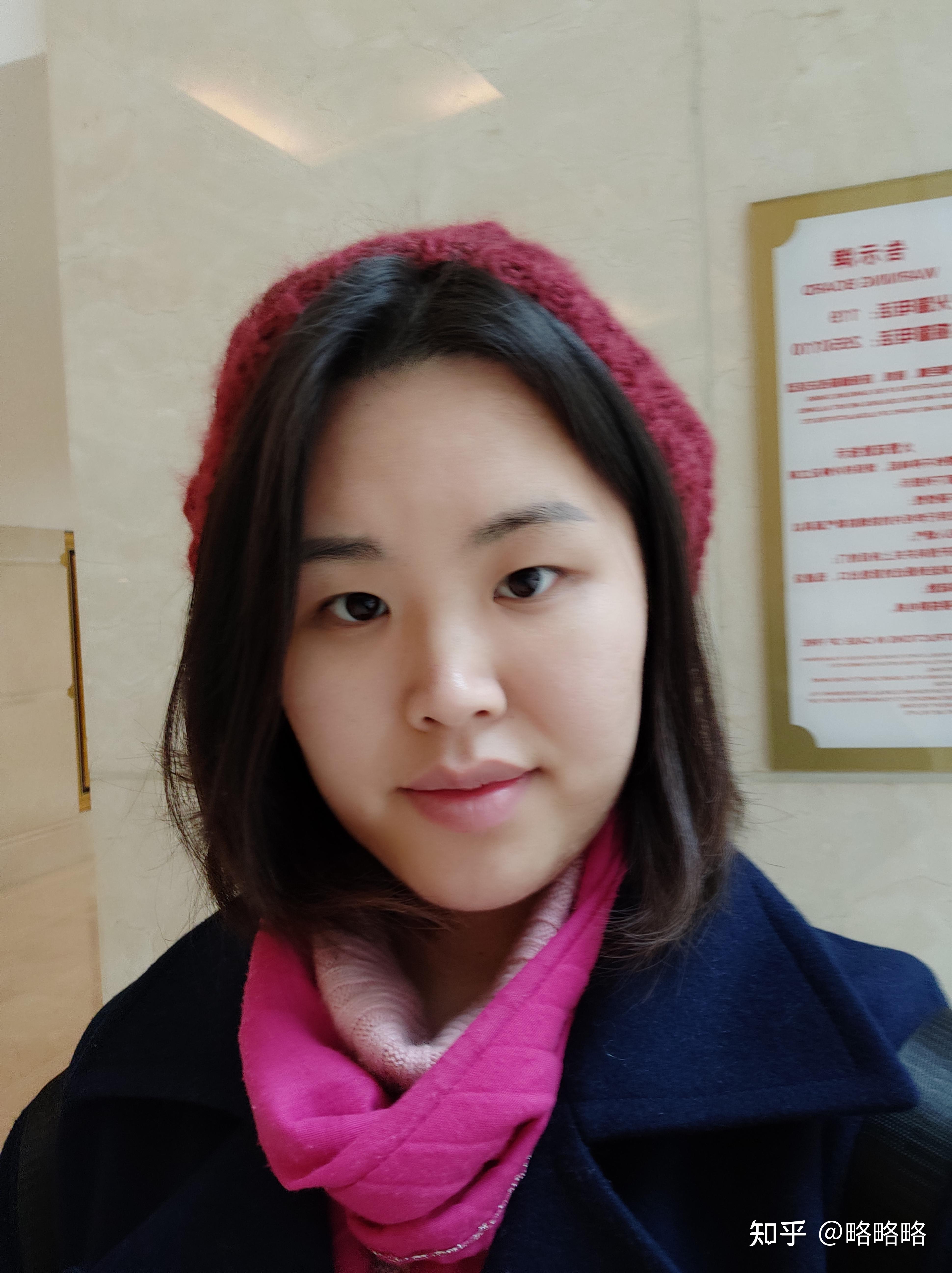 二氧化碳点阵激光恢复记录以及一个普通人的医美经历与心态