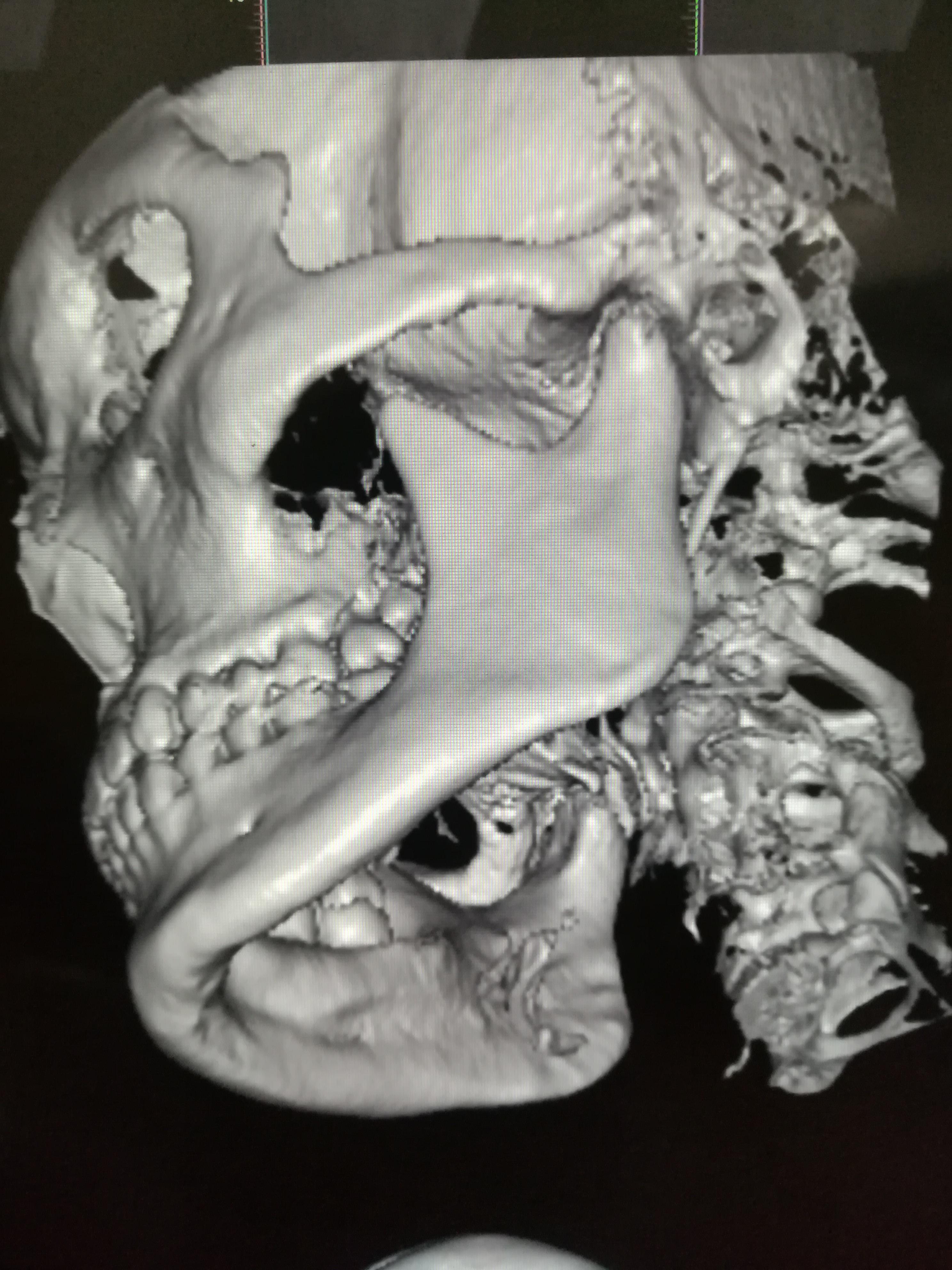 v2-45c2a7689c8b7312218ddd2ac7ce7afd_r.jpg