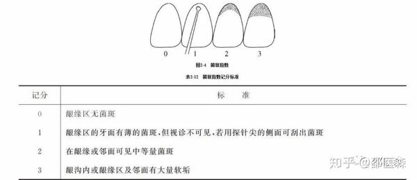 口腔规培考试重点(本人整理得巨细) - 知乎