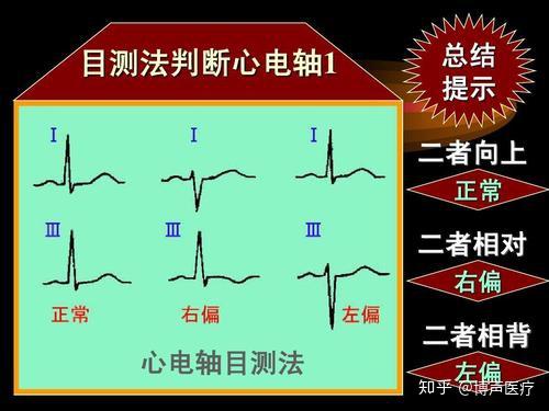 电轴 计算方法图片