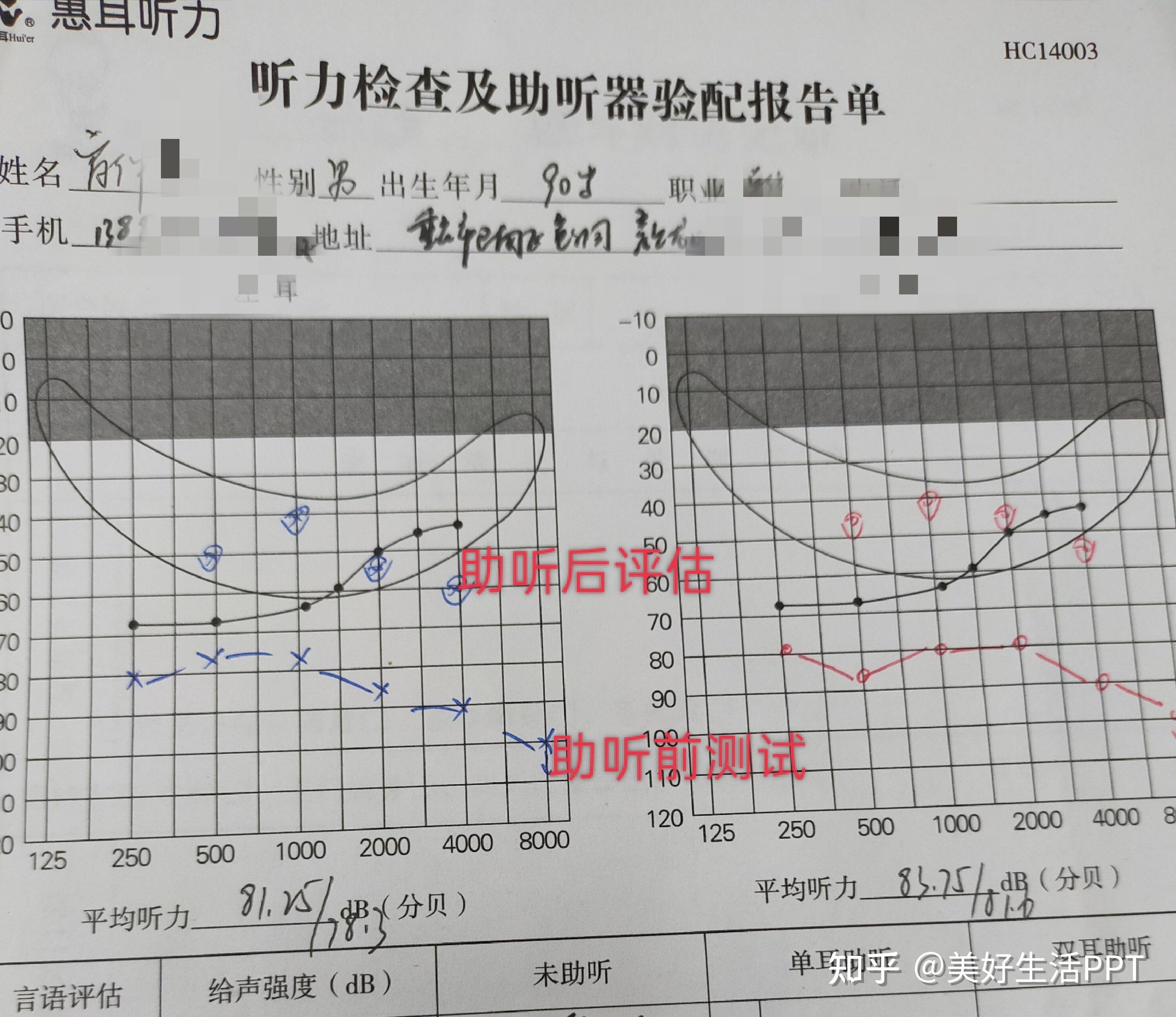 重庆（惠耳）助听器： 90岁的老年人还可以佩戴助听器吗？ - 知乎