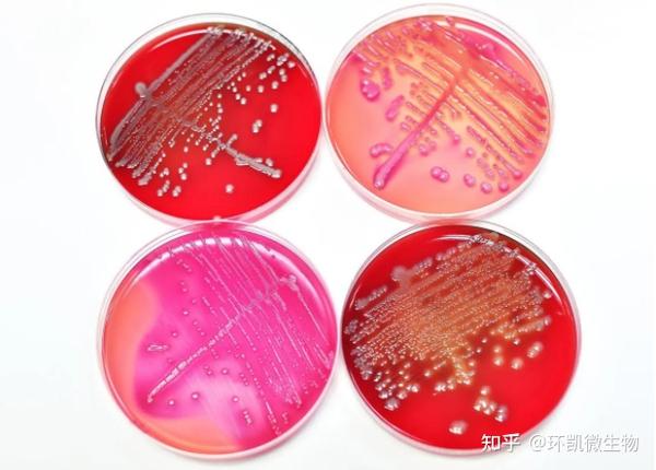 【速看】常见微生物在常见选择性培养基上的菌落特征 知乎