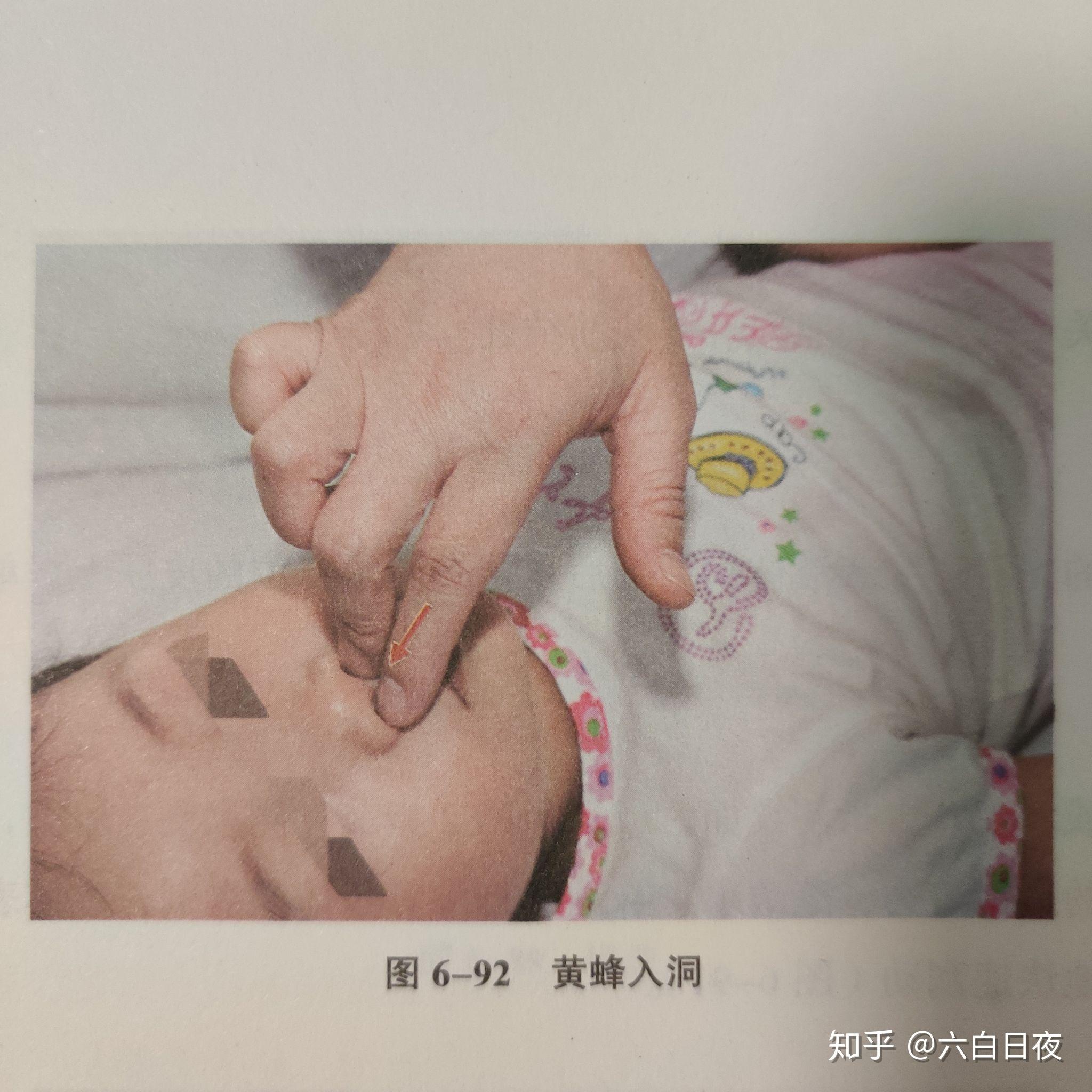 小儿推拿之→黄蜂入洞 - 知乎