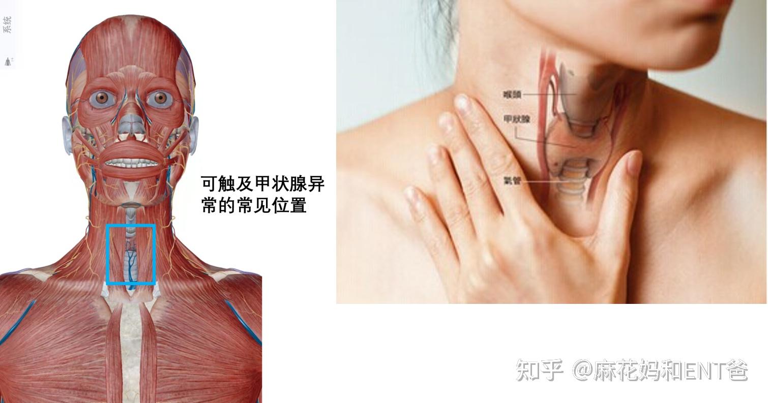 甲状腺脖子图片人体图片