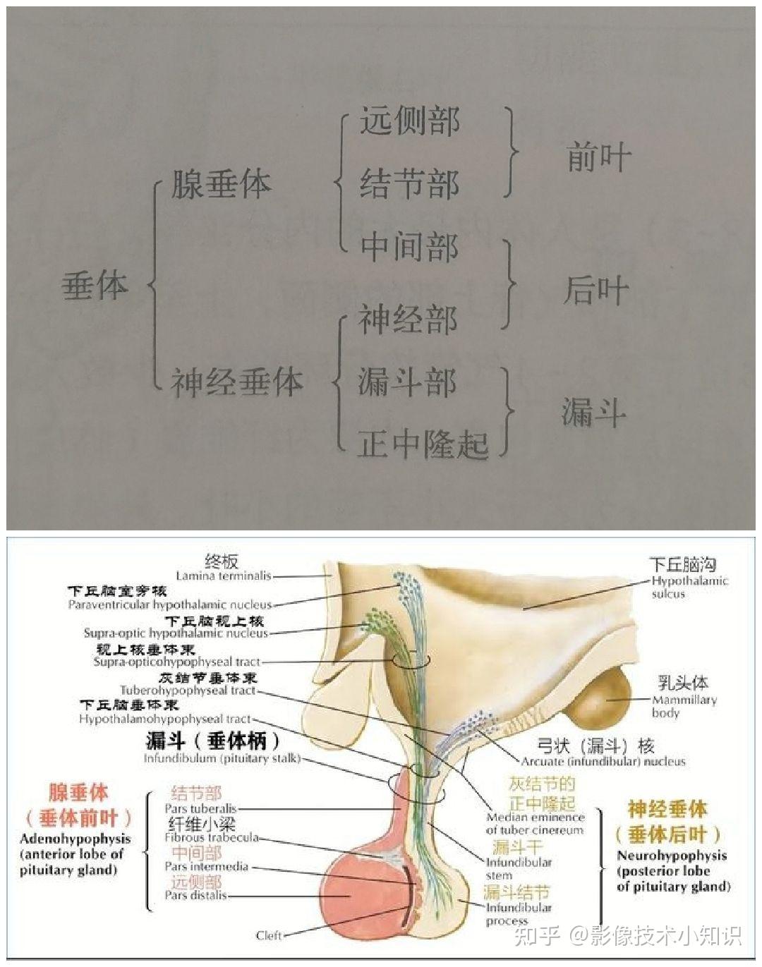 鞍区mri影像解剖