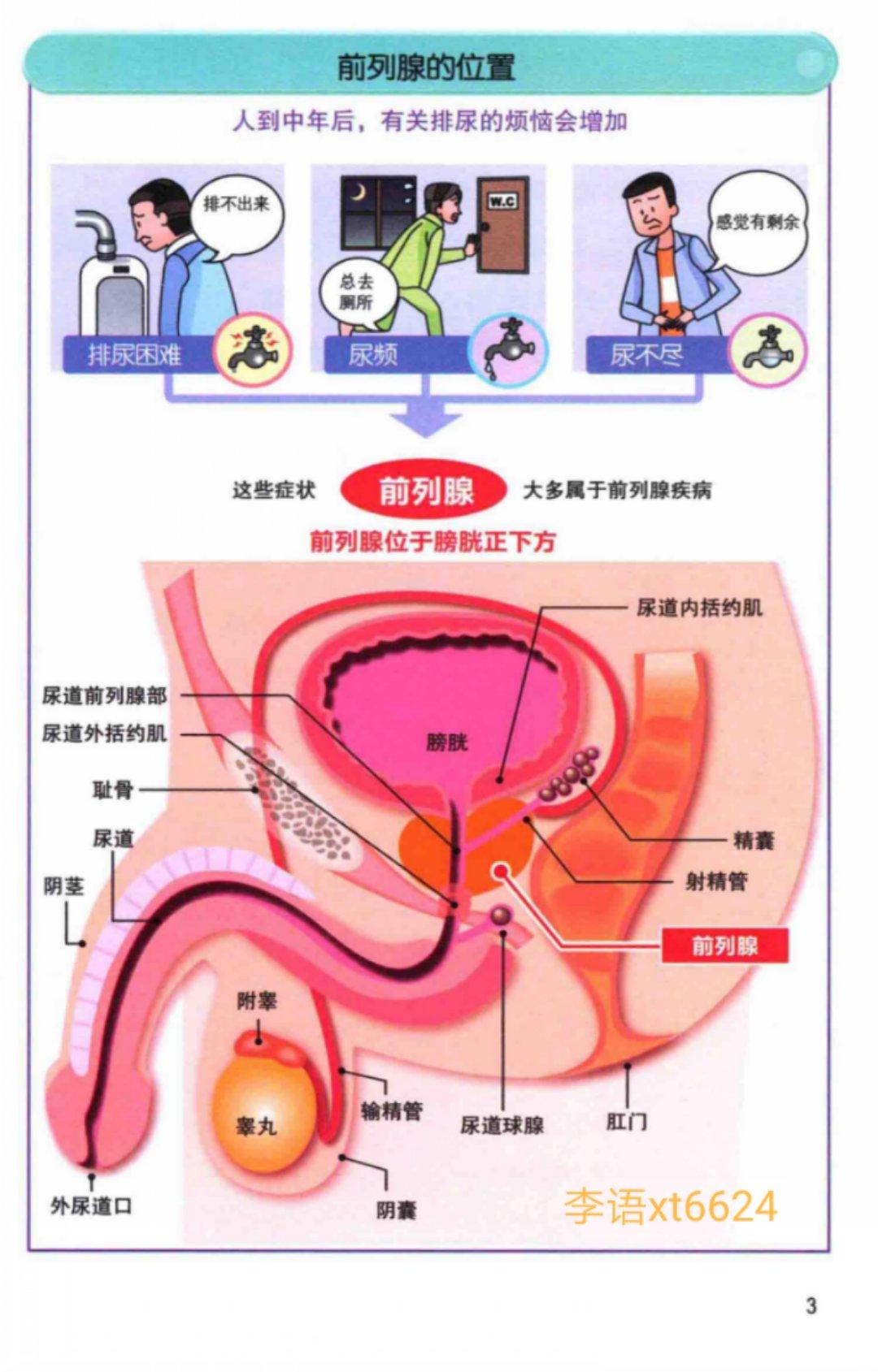 男子汉大丈夫因为一个前列腺钙化你就慌了