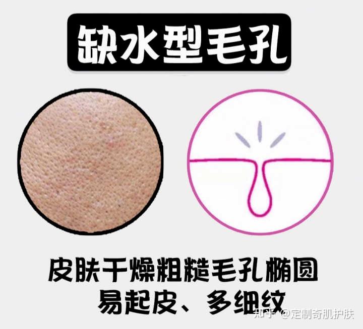 毛孔粗大,也是皮肤衰老的表现! - 知乎