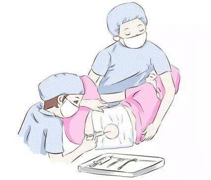 赴美生子之无痛分娩