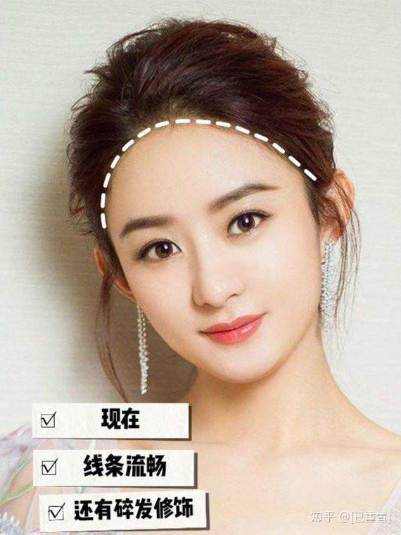 做发际线种植之前,一起来了解怎样的发际线才算好看? - 知乎